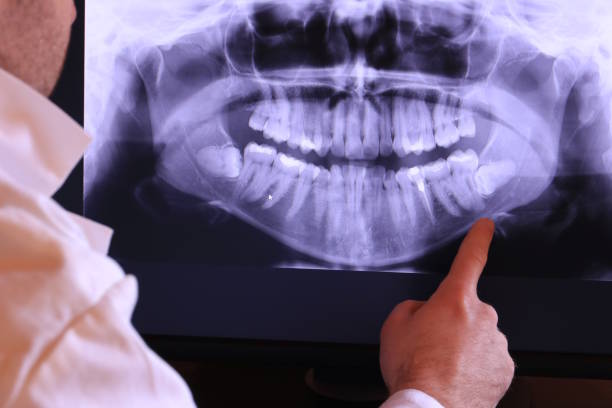 Best Broken or Chipped Tooth Repair in Jackson, OH