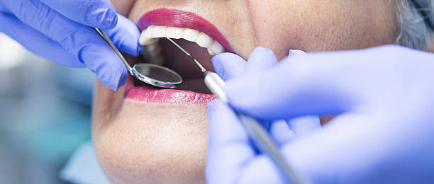 Best Emergency Wisdom Tooth Extraction in Jackson, OH